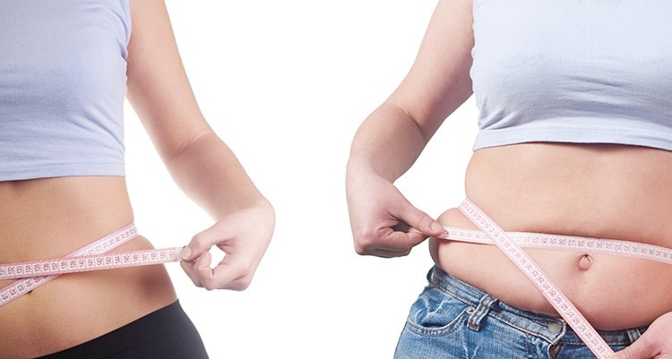 Know The Difference Between Liposuction and CoolSculpting