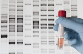 DNA Test